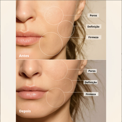 Masajeador Facial con Fototerapia Antiarrugas/ Efecto Lifting PRO