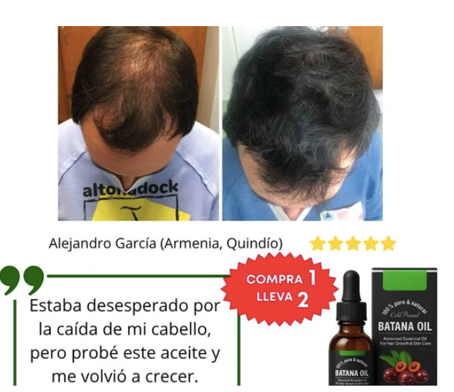 Aceite de Batana 100% puro