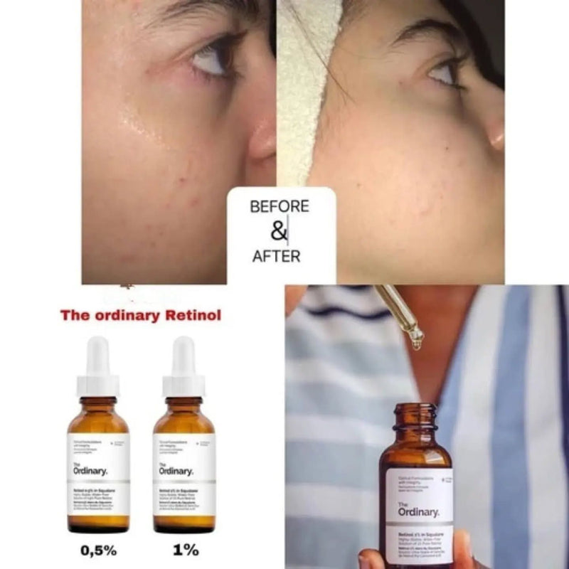 The Ordinary Retinol 0,5% en Escualano Sérum 30ml